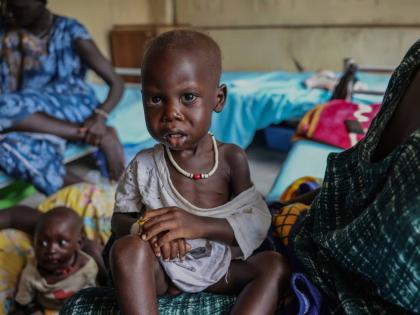 Adut Duor, 14 months old, sits on his mother’s lap in the malnutrition ward of Bunj Hospital in Maban, South Sudan on August 18.