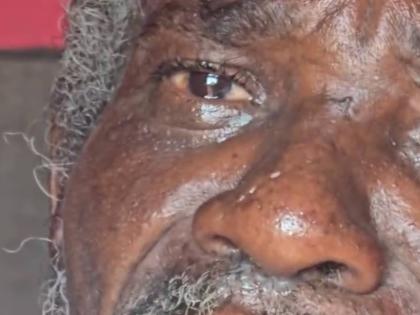 Sixty-year-old Alvaro Brevett, who is homeless and claims he was attacked by another homeless man who is believed to be of unsound mind. 