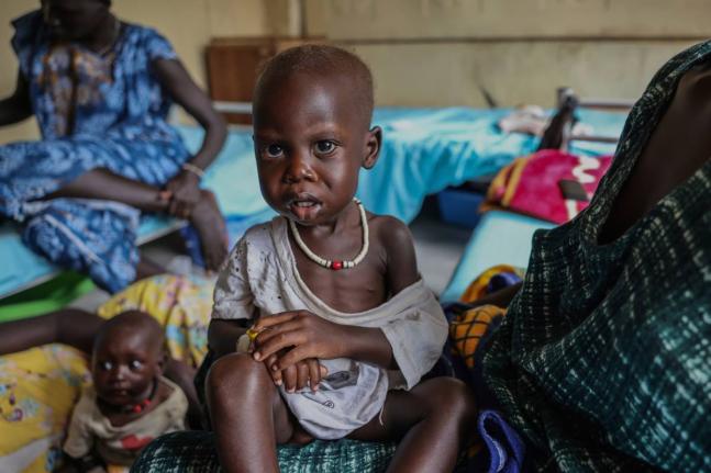 Adut Duor, 14 months old, sits on his mother’s lap in the malnutrition ward of Bunj Hospital in Maban, South Sudan on August 18.