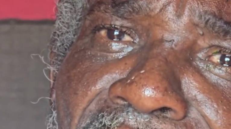 Sixty-year-old Alvaro Brevett, who is homeless and claims he was attacked by another homeless man who is believed to be of unsound mind. 